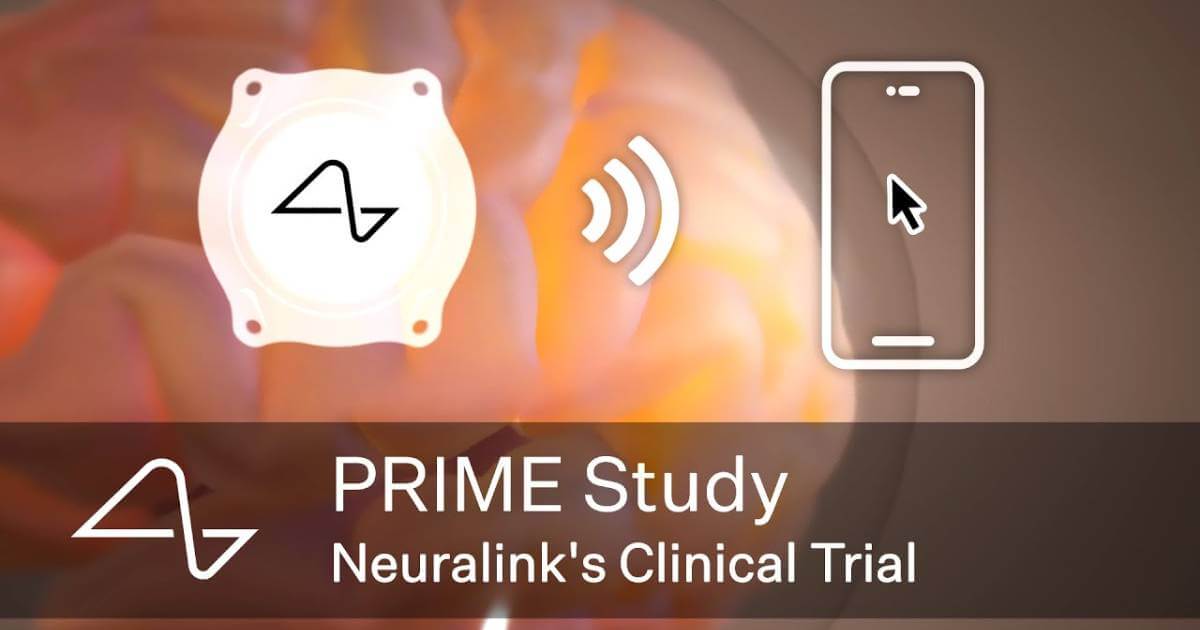 Neuralink’s Thought-Controlled Robotic Arm Technology Advances