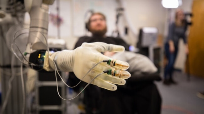 brain-controlled prosthetic limbs