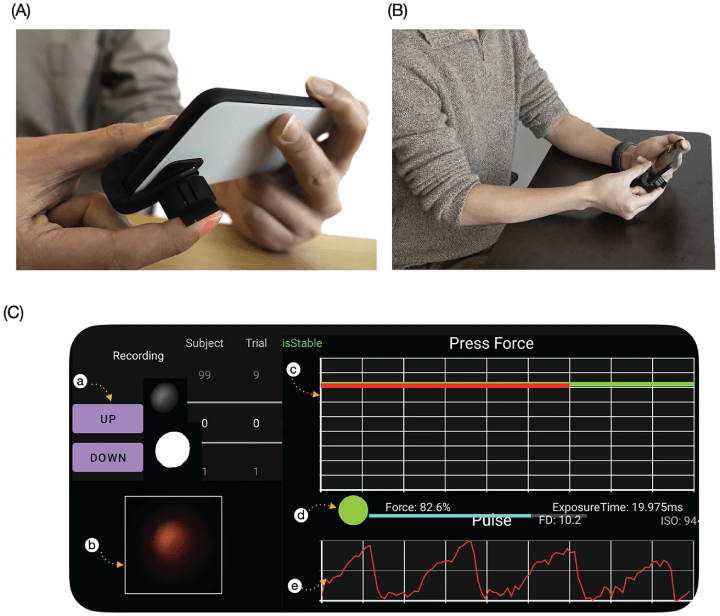 Ultra-low-cost mechanical smartphone attachment for no-calibration blood pressure measurement